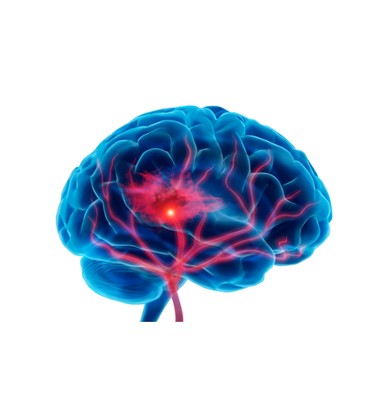 Neuro range PCD Companies