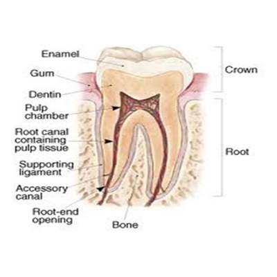 Root Canal Treatment