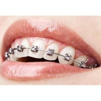 Braces Orthodontics