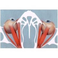 Squint Surgery and Management